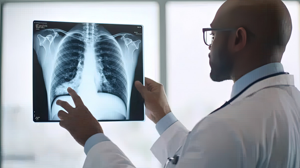 A doctor examines a chest x-ray